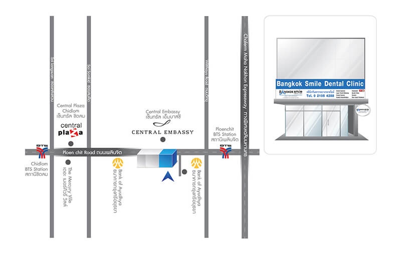 คลินิกทันตกรรม บางกอกสไมล์ สาขา เพลินจิต