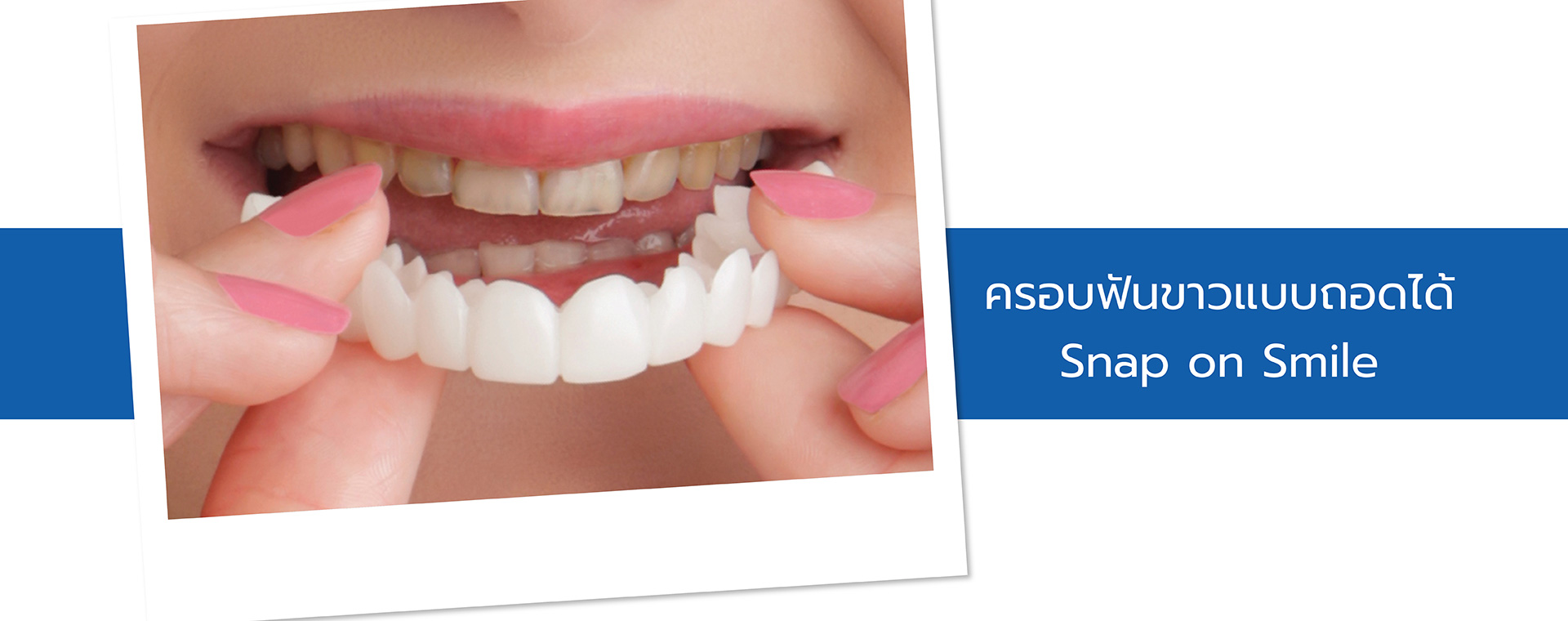 ครอบฟันขาว, คลินิกจัดฟัน, คลินิกทันตกรรม, จัดฟัน, จัดฟัน invisalign, จัดฟันแบบใส, ฟอกสีฟัน, ฟอกสีฟัน zoom, รักษารากฟัน, รากฟันเทียม, วีเนียร์, เพลินจิต, สีลม, สุขุมวิท, อโศก