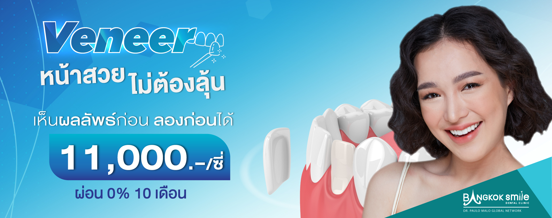 ครอบฟันขาว, คลินิกจัดฟัน, คลินิกทันตกรรม, จัดฟัน, จัดฟัน invisalign, จัดฟันแบบใส, ฟอกสีฟัน, ฟอกสีฟัน zoom, รักษารากฟัน, รากฟันเทียม, วีเนียร์, เพลินจิต, สีลม, สุขุมวิท, อโศก