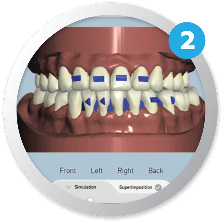 ครอบฟันขาว, คลินิกจัดฟัน, คลินิกทันตกรรม, จัดฟัน, จัดฟัน invisalign, จัดฟันแบบใส, ฟอกสีฟัน, ฟอกสีฟัน zoom, รักษารากฟัน, รากฟันเทียม, วีเนียร์, เพลินจิต, สีลม, สุขุมวิท, อโศก