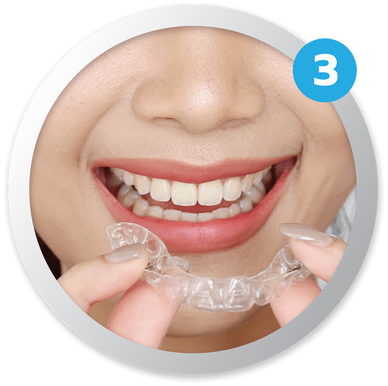 ครอบฟันขาว, คลินิกจัดฟัน, คลินิกทันตกรรม, จัดฟัน, จัดฟัน invisalign, จัดฟันแบบใส, ฟอกสีฟัน, ฟอกสีฟัน zoom, รักษารากฟัน, รากฟันเทียม, วีเนียร์, เพลินจิต, สีลม, สุขุมวิท, อโศก