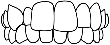 ครอบฟันขาว, คลินิกจัดฟัน, คลินิกทันตกรรม, จัดฟัน, จัดฟัน invisalign, จัดฟันแบบใส, ฟอกสีฟัน, ฟอกสีฟัน zoom, รักษารากฟัน, รากฟันเทียม, วีเนียร์, เพลินจิต, สีลม, สุขุมวิท, อโศก