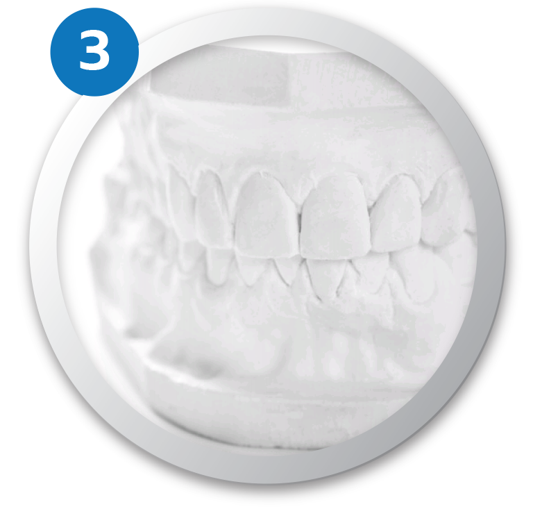 ครอบฟันขาว, คลินิกจัดฟัน, คลินิกทันตกรรม, จัดฟัน, จัดฟัน invisalign, จัดฟันแบบใส, ฟอกสีฟัน, ฟอกสีฟัน zoom, รักษารากฟัน, รากฟันเทียม, วีเนียร์, เพลินจิต, สีลม, สุขุมวิท, อโศก