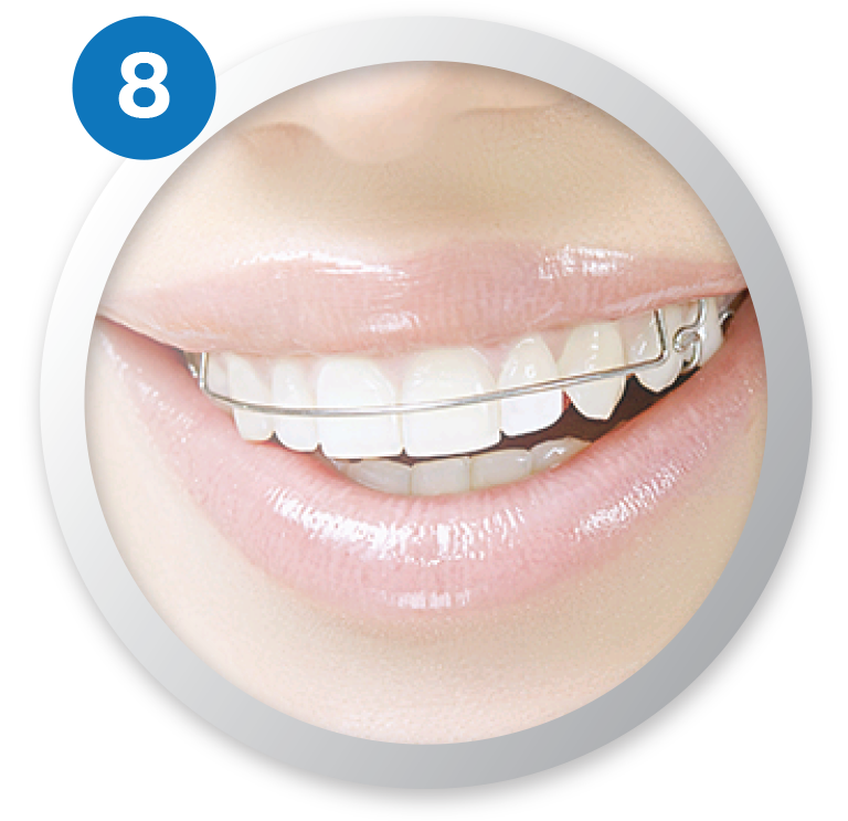 ครอบฟันขาว, คลินิกจัดฟัน, คลินิกทันตกรรม, จัดฟัน, จัดฟัน invisalign, จัดฟันแบบใส, ฟอกสีฟัน, ฟอกสีฟัน zoom, รักษารากฟัน, รากฟันเทียม, วีเนียร์, เพลินจิต, สีลม, สุขุมวิท, อโศก