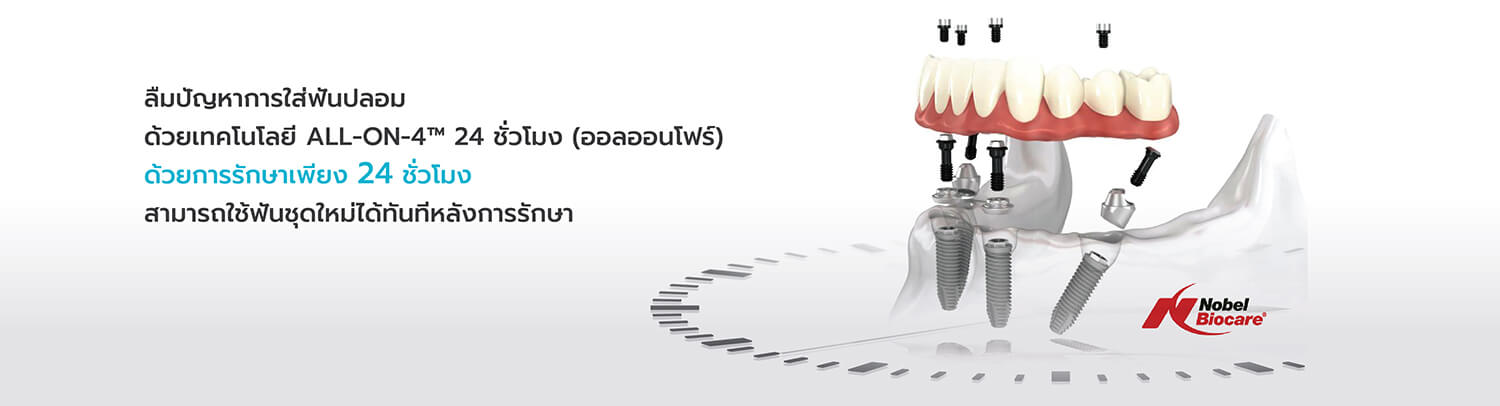 ครอบฟันขาว, คลินิกจัดฟัน, คลินิกทันตกรรม, จัดฟัน, จัดฟัน invisalign, จัดฟันแบบใส, ฟอกสีฟัน, ฟอกสีฟัน zoom, รักษารากฟัน, รากฟันเทียม, วีเนียร์, เพลินจิต, สีลม, สุขุมวิท, อโศก