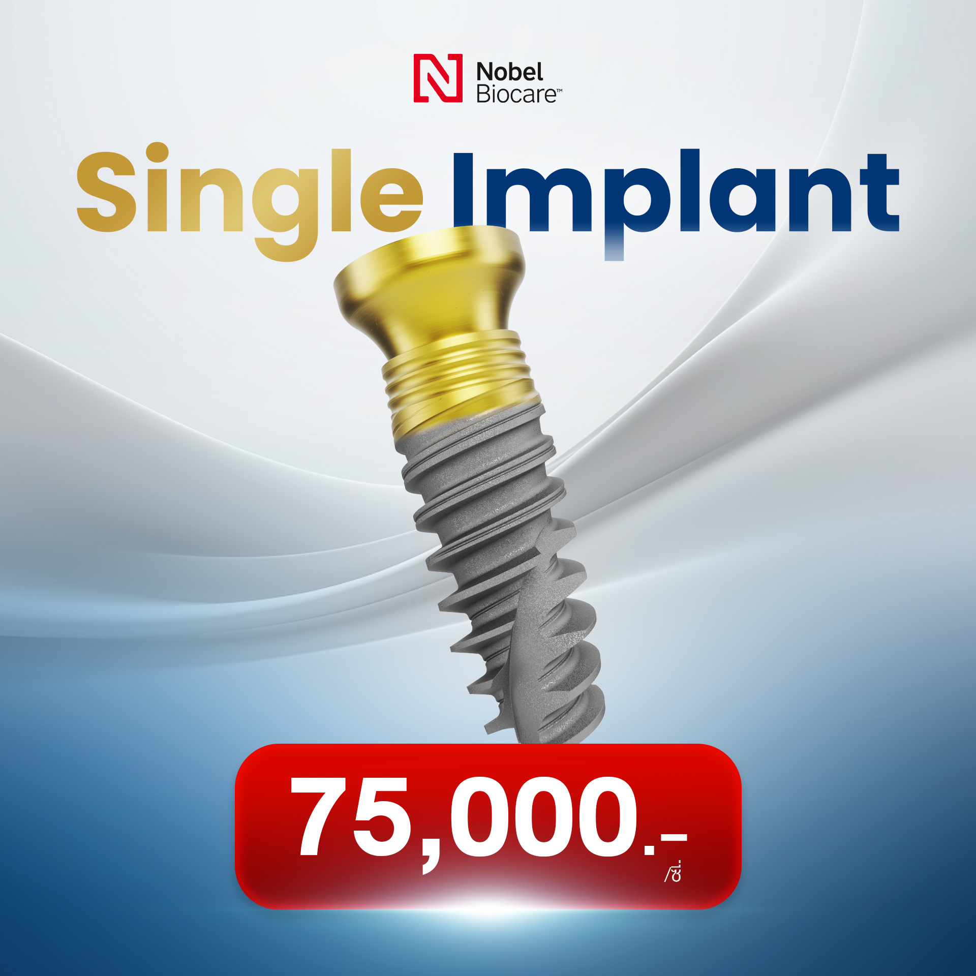 Single Implant Price Nobel Biocare
