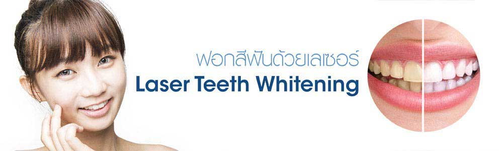 ครอบฟันขาว, คลินิกจัดฟัน, คลินิกทันตกรรม, จัดฟัน, จัดฟัน invisalign, จัดฟันแบบใส, ฟอกสีฟัน, ฟอกสีฟัน zoom, รักษารากฟัน, รากฟันเทียม, วีเนียร์, เพลินจิต, สีลม, สุขุมวิท, อโศก