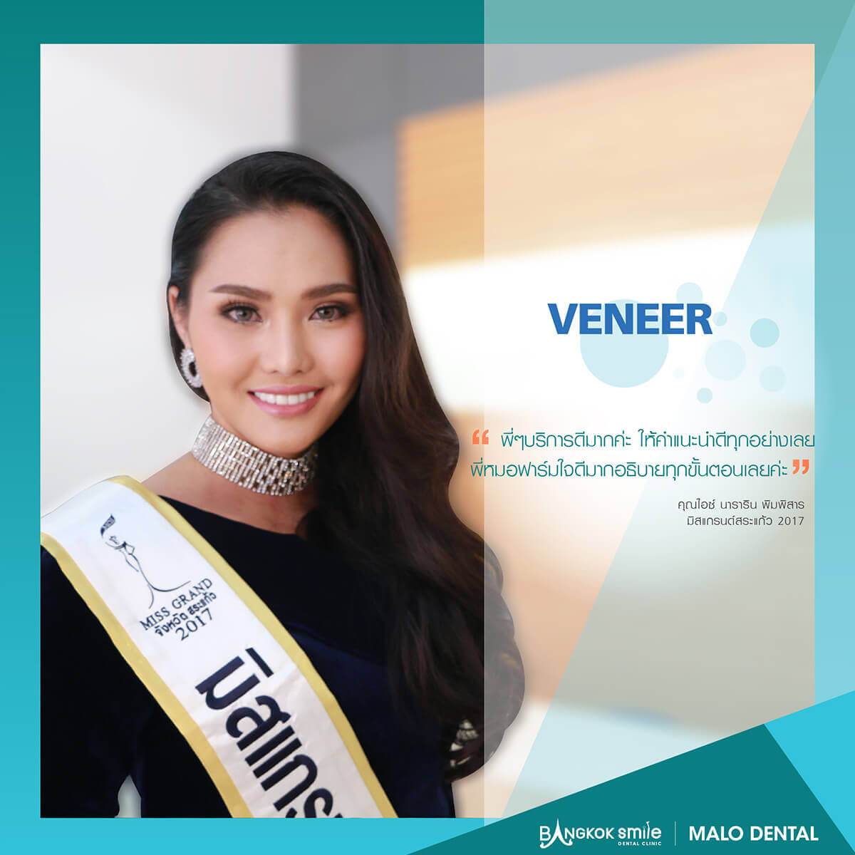 veneer testimonial