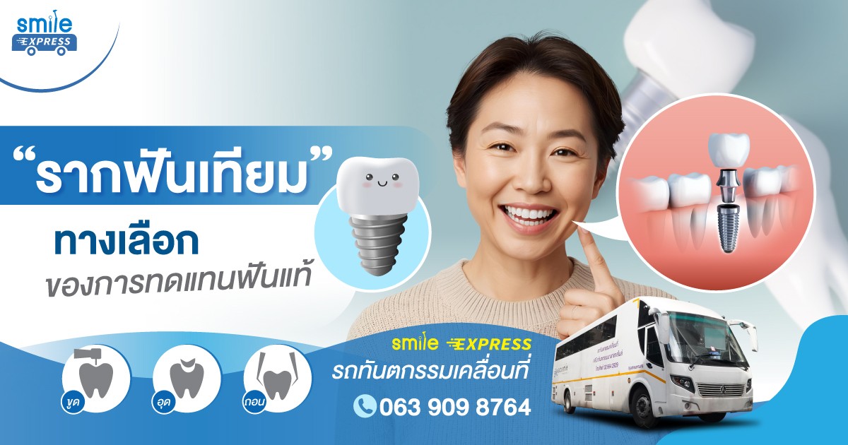 รากฟันเทียม ทางเลือกของการทดแทนฟันแท้