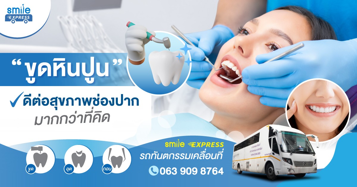 ขูดหินปูนดีต่อสุขภาพช่องปากมากกว่าที่คิด