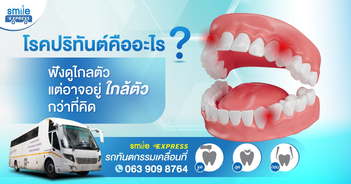 โรคปริทันต์คืออะไร? ฟังดูไกลตัวแต่อาจอยู่ใกล้ตัวกว่าที่คิด