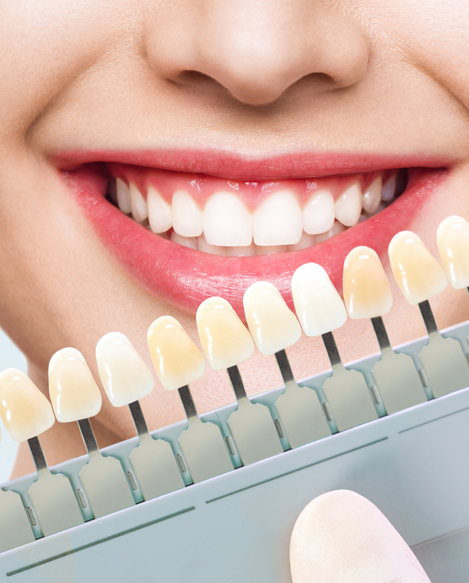 TEETH WHITENINGฟอกสีฟัน