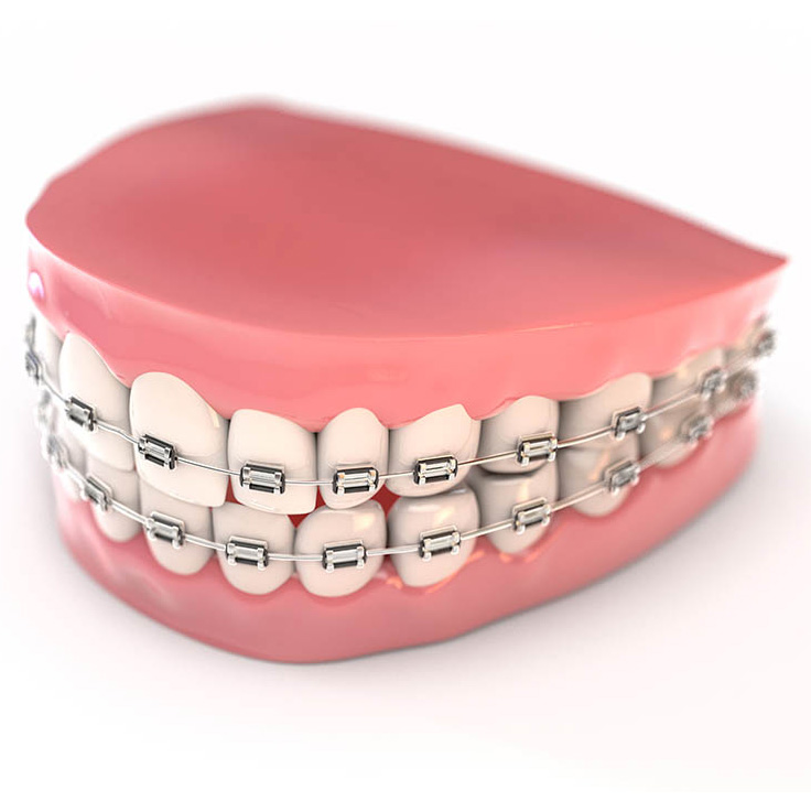 ฟันปลอมชนิดถอดได้บางส่วน false teeth